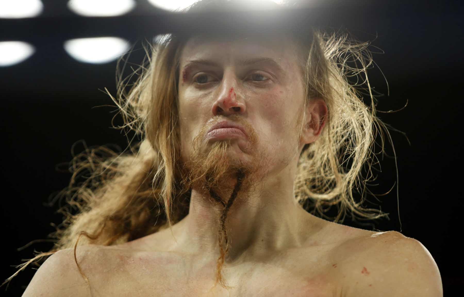 Bare-knuckle fighting